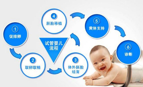 试管婴儿流程