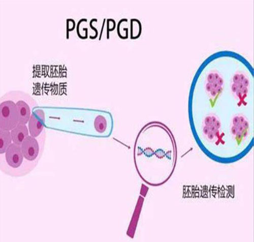 PGD/PGS技术