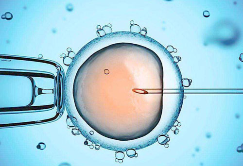 IVF