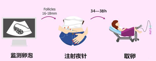 美国试管婴儿促排针