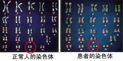 染色体检查