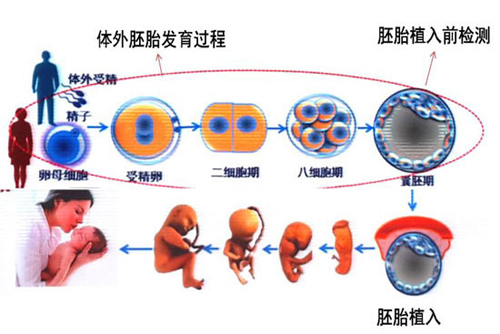 美国试管婴儿胚胎移植