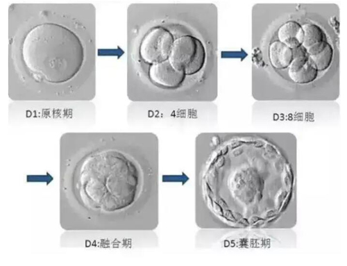 美国试管婴儿培育