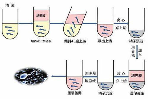 美国试管婴儿精子洗涤技术
